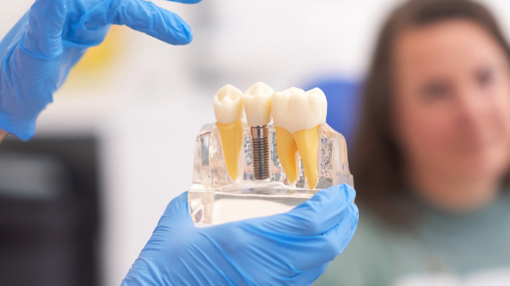 Close up of a dentist explaining the dental implants procedure