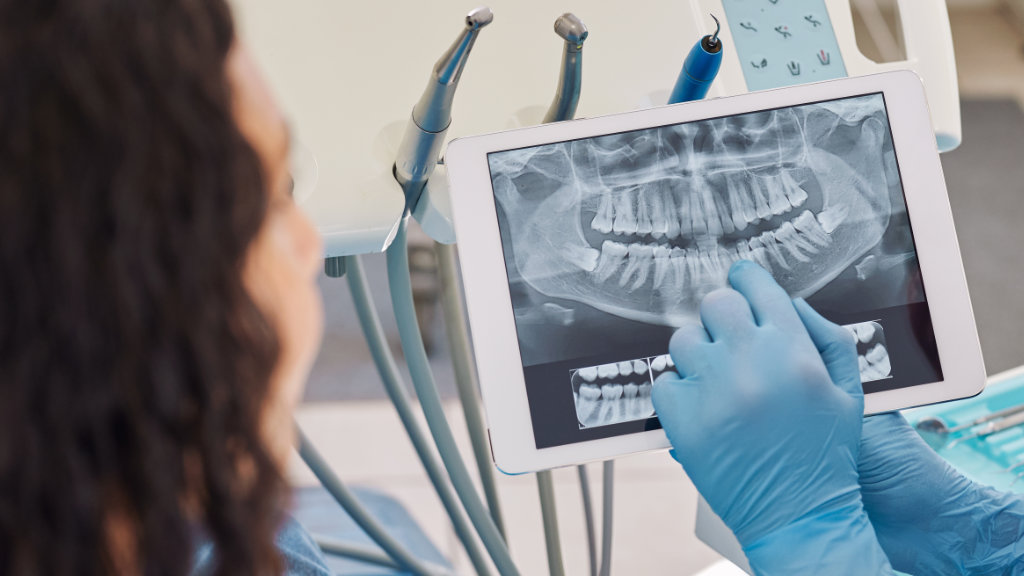 Dentist with X Ray explaining bone grafting procedure